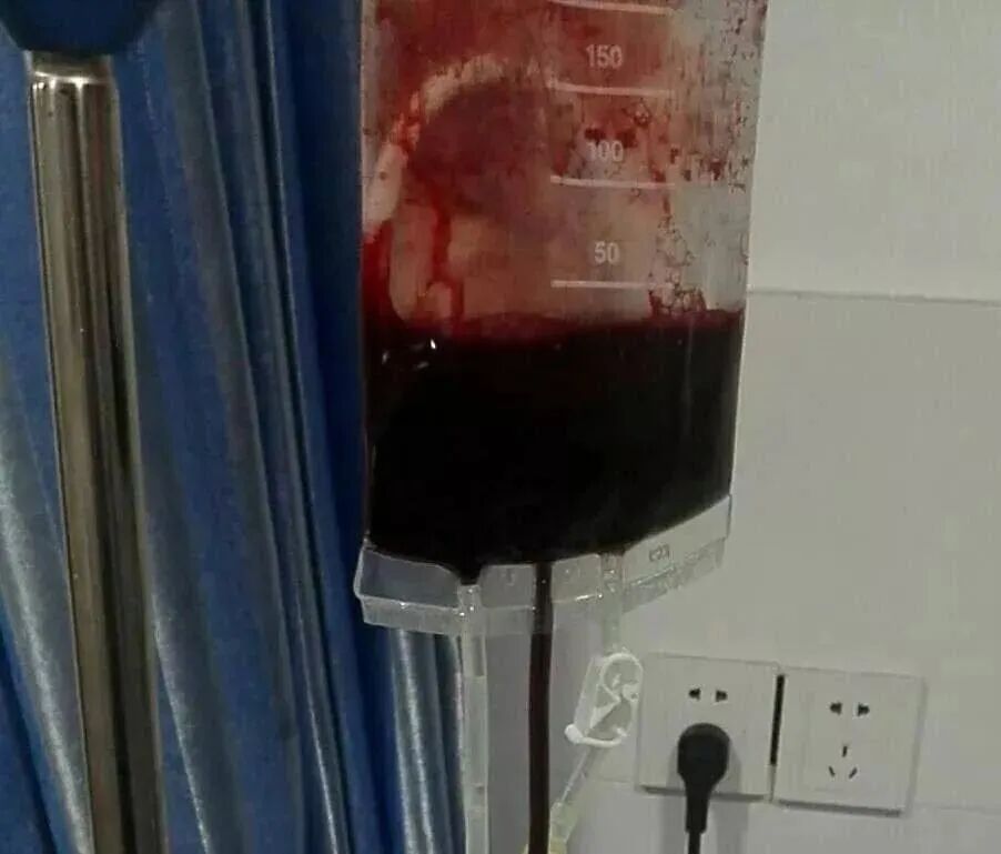 什么是臭氧大自血疗法【专家共识】三氧大自血疗法--血液好身体就好！_https://www.jmylbn.com_新闻资讯_第5张