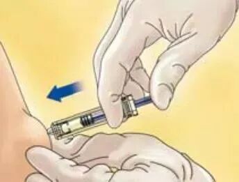 打肝素怎么拔针低分子肝素钙的注射方法&注意事项     收了！_https://www.jmylbn.com_新闻资讯_第7张