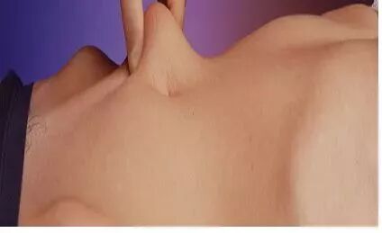 打肝素怎么拔针低分子肝素钙的注射方法&注意事项     收了！_https://www.jmylbn.com_新闻资讯_第9张