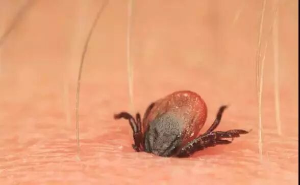正往人类皮肤里钻的蜱虫