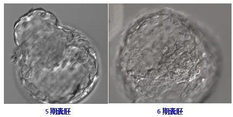 胚胎质量越好出生宝宝越聪明吗_胚胎等级越高孩子越聪明_二级胚胎没有一级聪明