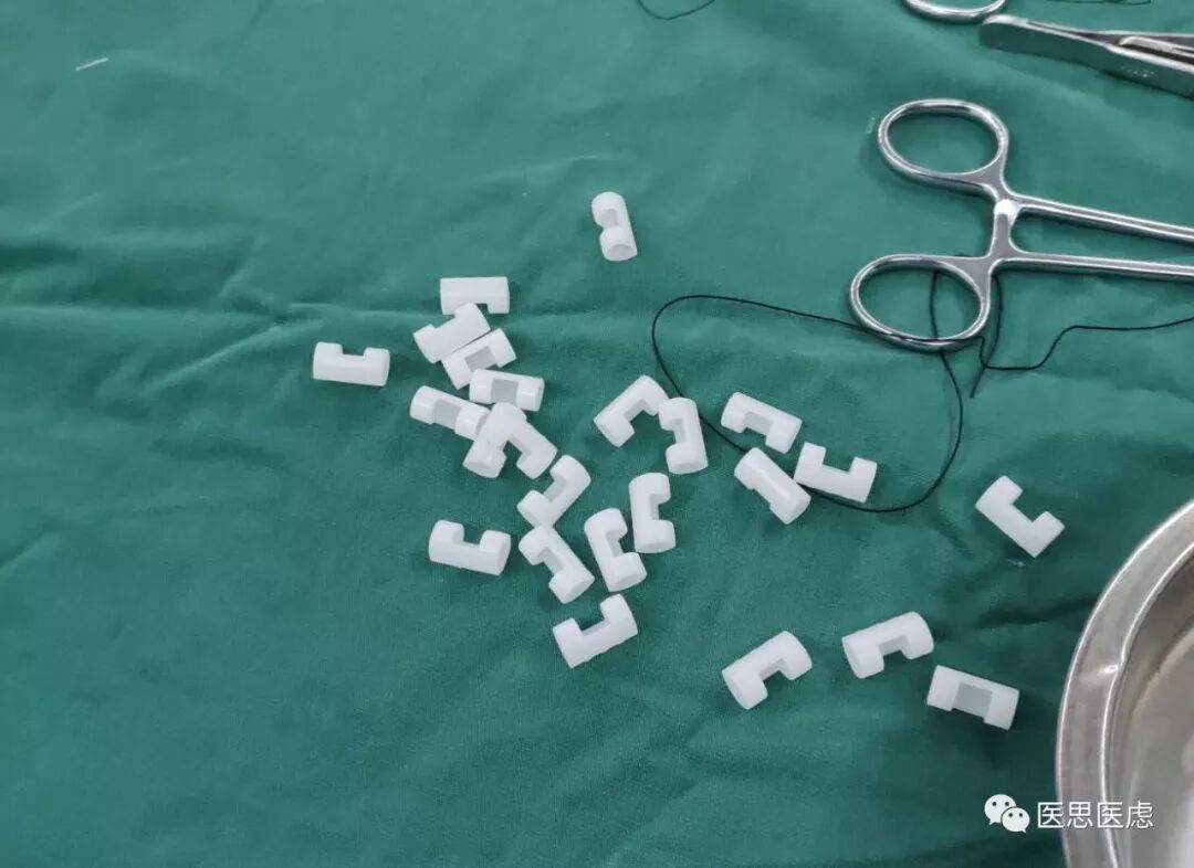 手术头皮夹怎么放神外有趣的小物件---头皮夹_https://www.jmylbn.com_新闻资讯_第4张