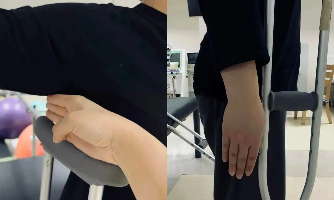 肘拐怎么用健康科普丨这些五花八门的拐杖都该怎么用？_https://www.jmylbn.com_新闻资讯_第10张