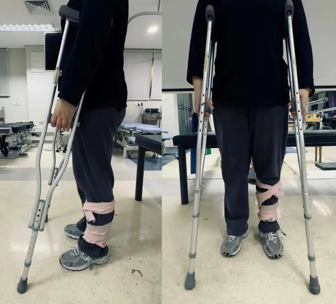 肘拐怎么用健康科普丨这些五花八门的拐杖都该怎么用？_https://www.jmylbn.com_新闻资讯_第11张