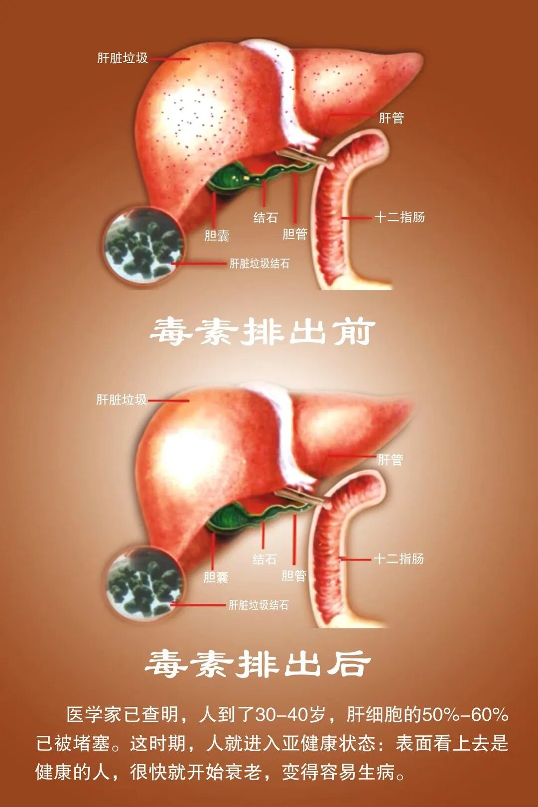 结肠水疗仪怎么用【结肠透析治疗机】便秘患者的福音——给肠道“洗个澡”_https://www.jmylbn.com_新闻资讯_第12张
