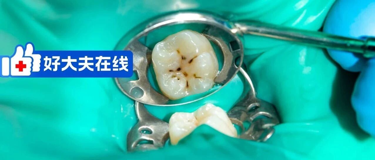 做好护牙，为你省钱省心省事儿