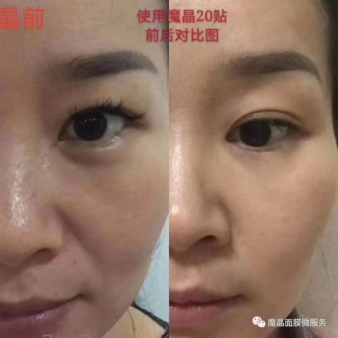 魔晶微整面膜全国火热招商中,欢迎各优秀团队和个人前来对接,咨询微信
