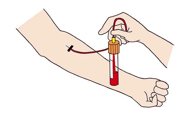 采血管颜色代表什么冷知识！五颜六色的采血管背后的秘密你知道吗？_https://www.jmylbn.com_新闻资讯_第2张