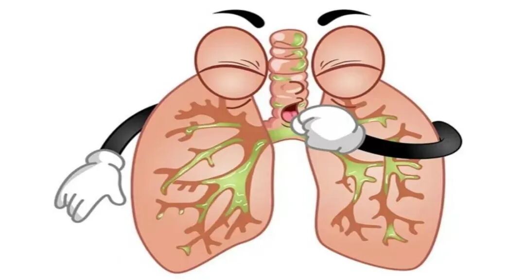 肺部结节 肺部结节