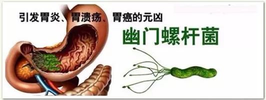 幽门螺旋杆菌，你中招了吗？