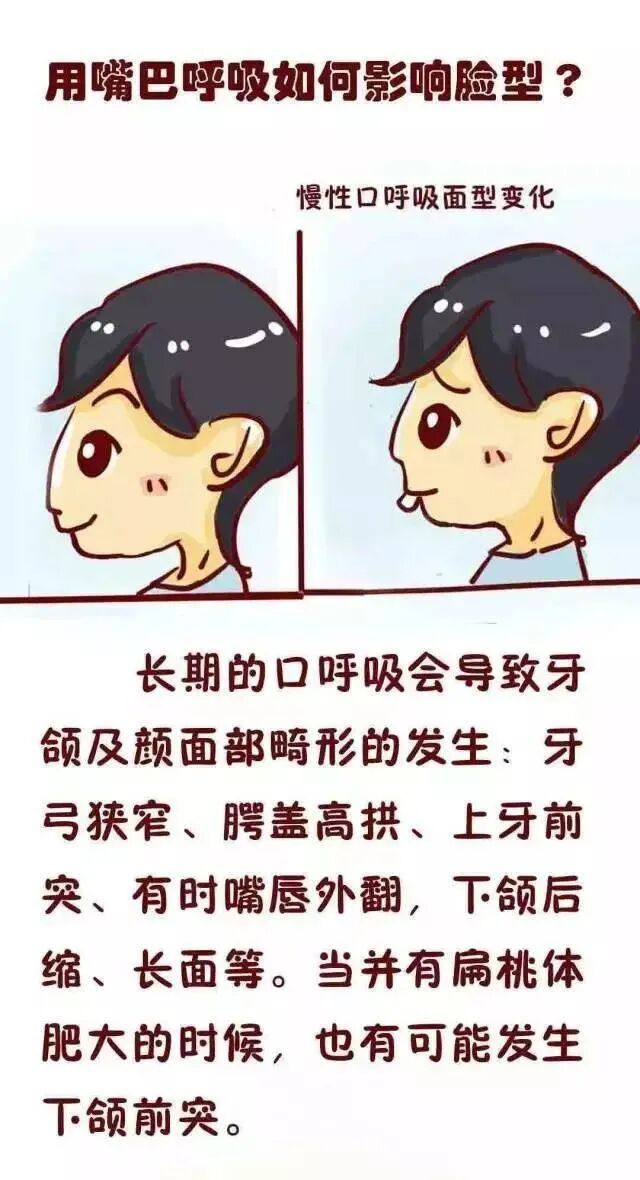 漫画 | 原来，口呼吸的影响这么大......