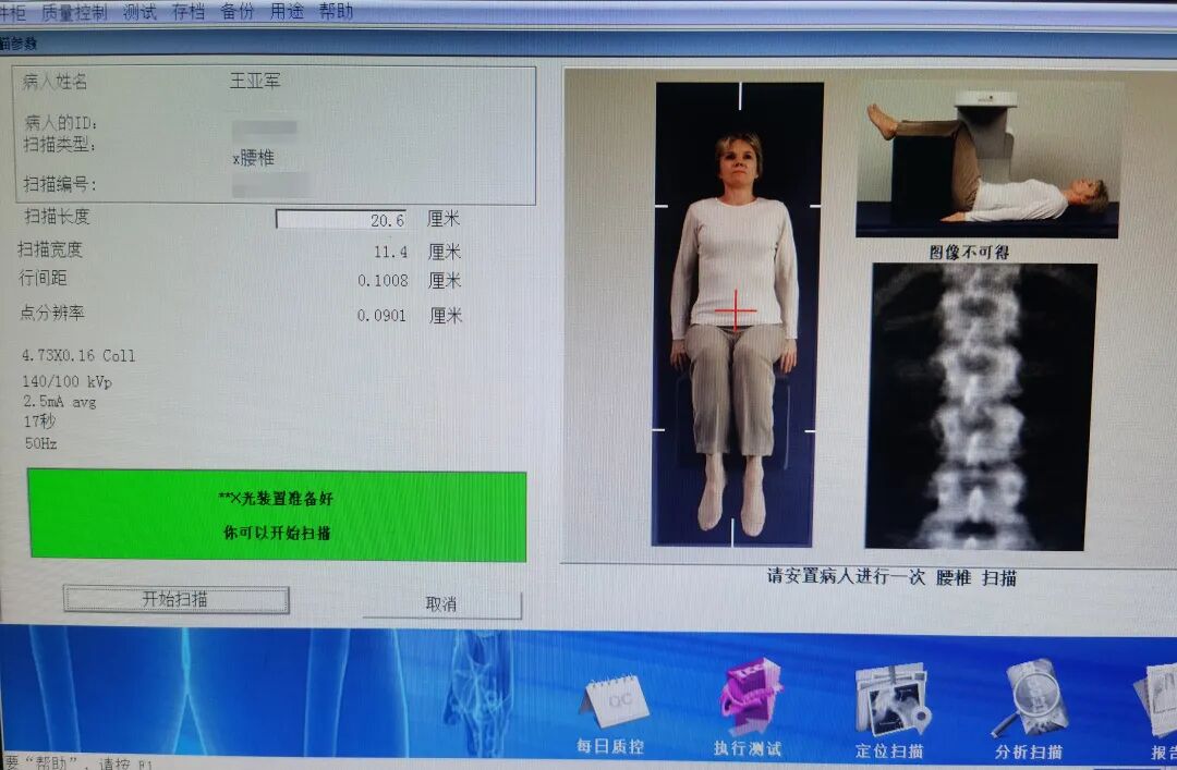 双能x骨密度检测仪为什么非得输入体重身高【科普】关于骨密度，你想知道的在这里！_https://www.jmylbn.com_新闻资讯_第4张