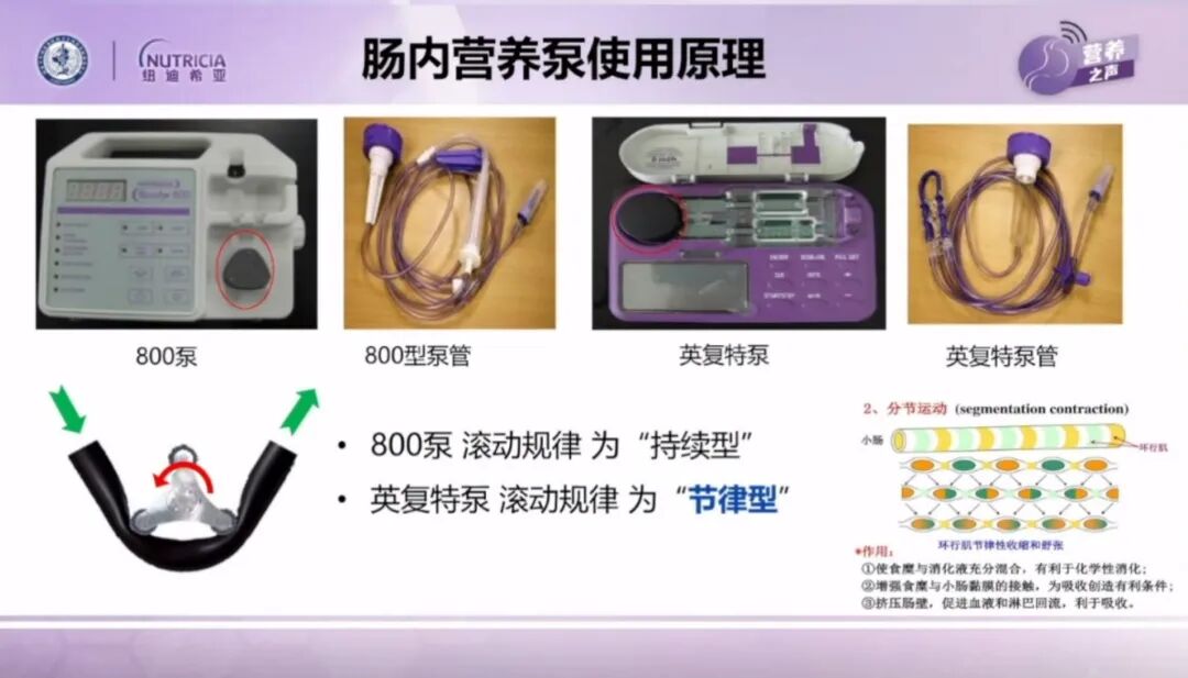 为什么用营养泵课程回放：《肠内营养泵应用技术及消化液回输护理》——孙琳教授_https://www.jmylbn.com_新闻资讯_第1张