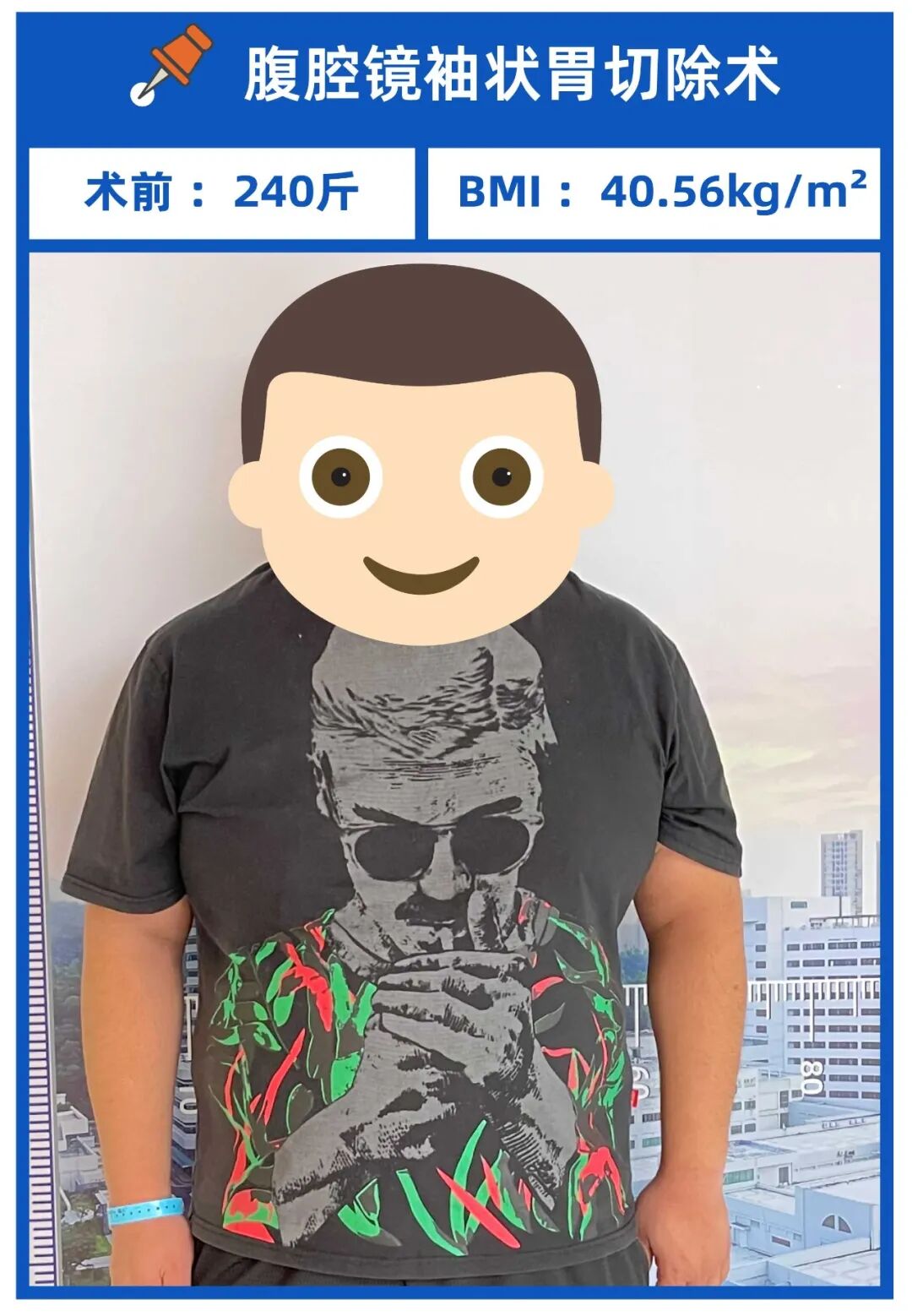 減肥手術多少錢_手術減肥_減肥手術是怎么做的