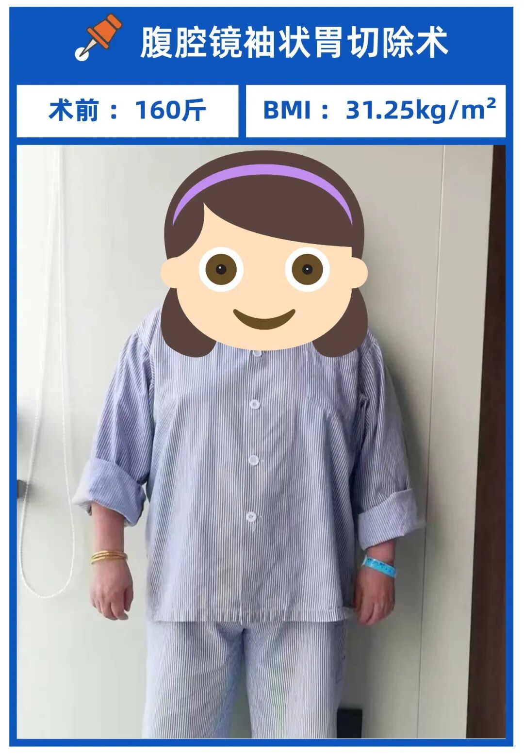 手術減肥_減肥手術是怎么做的_減肥手術多少錢