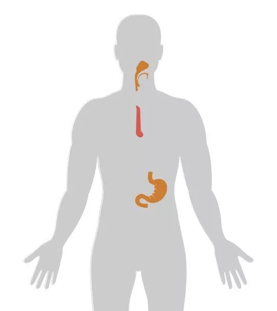 人體癌症地圖，全面揭示導致癌症的常見因素！ 健康 第5張