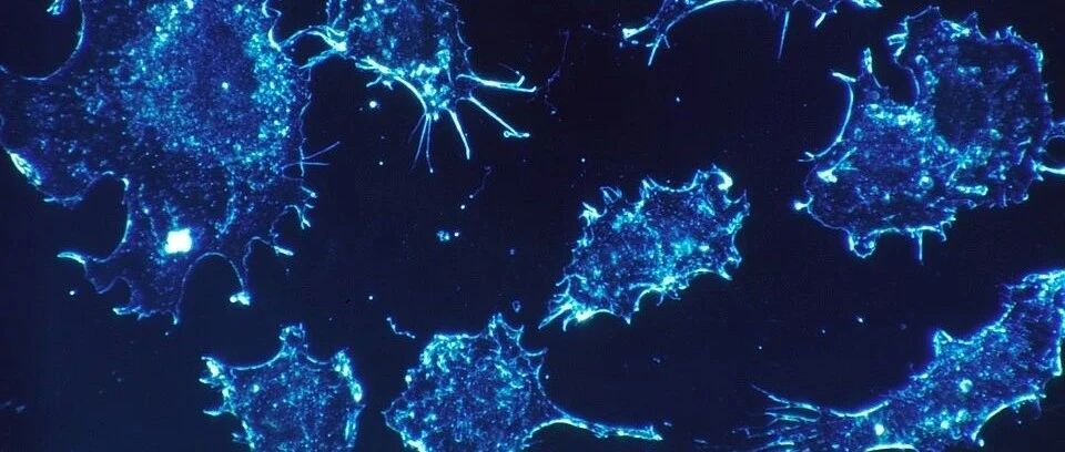 肿瘤分期是什么、有什么区别、对预后有何影响？一文为你解答