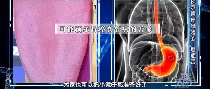 身体好不好，都写在脸上！脸上出现这些变化，就要小心了！