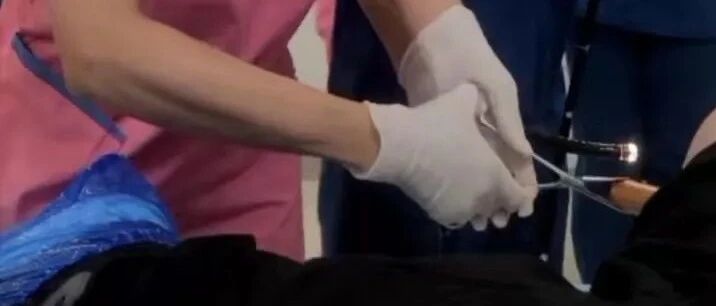 沈阳一男子难忍便秘折磨，竟将30厘米“擀面杖”置入肛门通便……