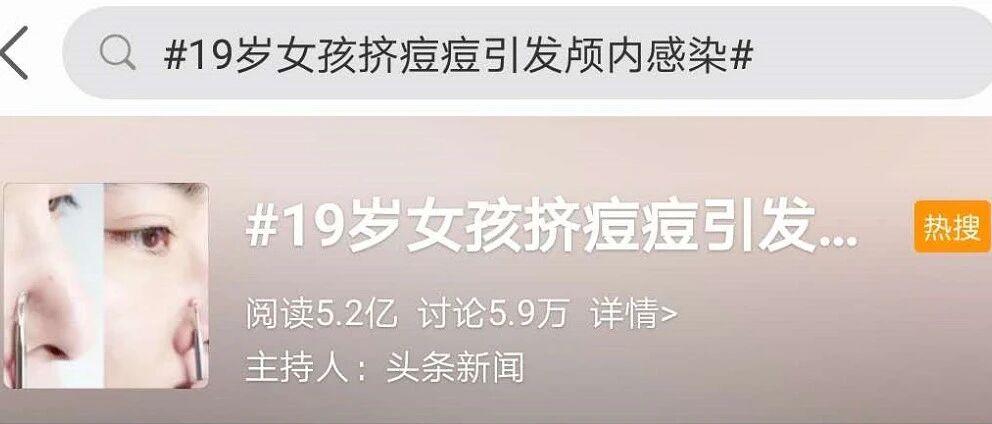19岁女孩颅内感染，冲上热搜第一！3万多名网友吓懵：原来我真的命大！