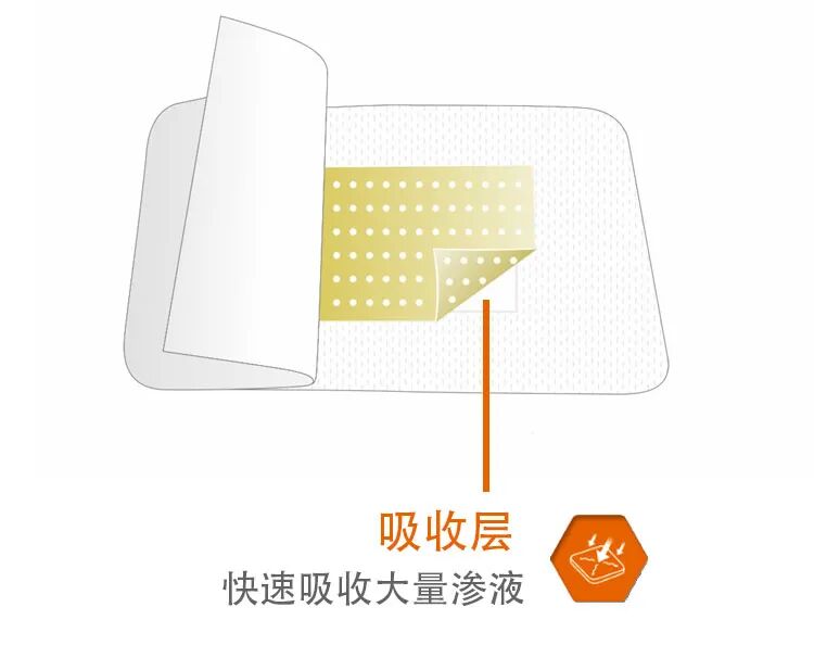 壳聚糖护创敷料怎么用一篇文，带你了解华卫·护创壳聚糖敷料_https://www.jmylbn.com_新闻资讯_第5张