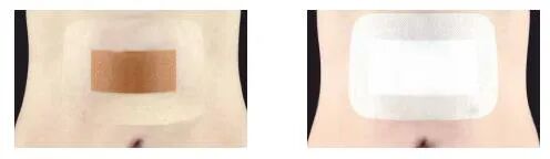 壳聚糖护创敷料怎么用一篇文，带你了解华卫·护创壳聚糖敷料_https://www.jmylbn.com_新闻资讯_第12张