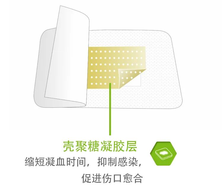 壳聚糖护创敷料怎么用一篇文，带你了解华卫·护创壳聚糖敷料_https://www.jmylbn.com_新闻资讯_第6张