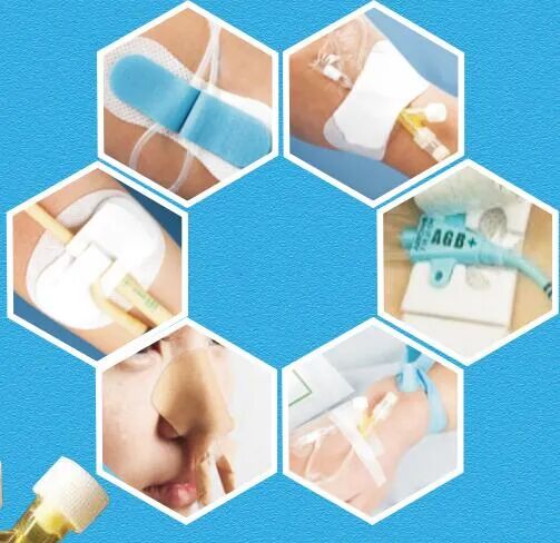 体表导管固定怎么使用护理知识 ｜ 导管固定，就是这么简单！_https://www.jmylbn.com_新闻资讯_第7张