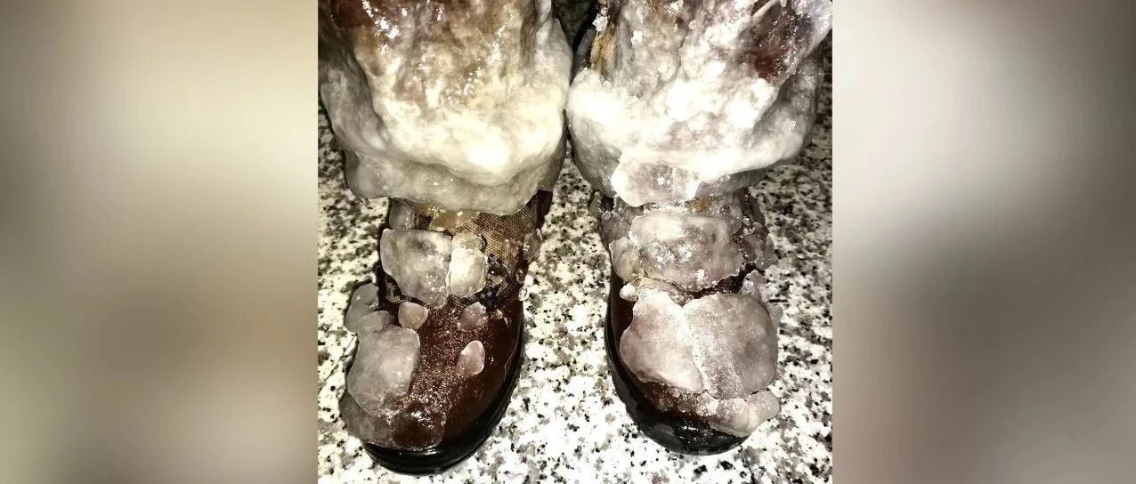 这双被冻住的脚，看哭了……