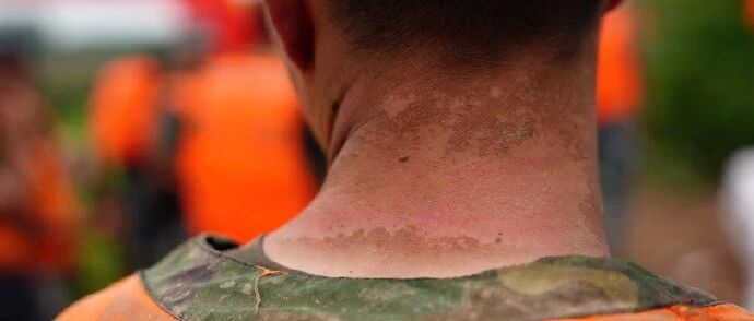 他们说这是“勋章”！网友：心疼……