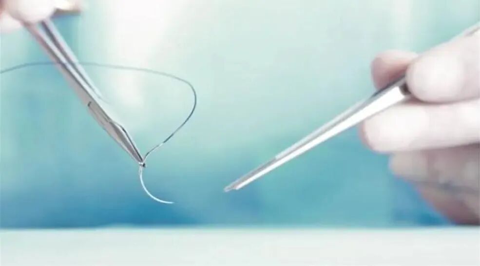 为什么要用皮肤缝合器【川骨知乎】缝合伤口用 “订书机”!？ 带您了解皮肤缝合器_https://www.jmylbn.com_新闻资讯_第5张