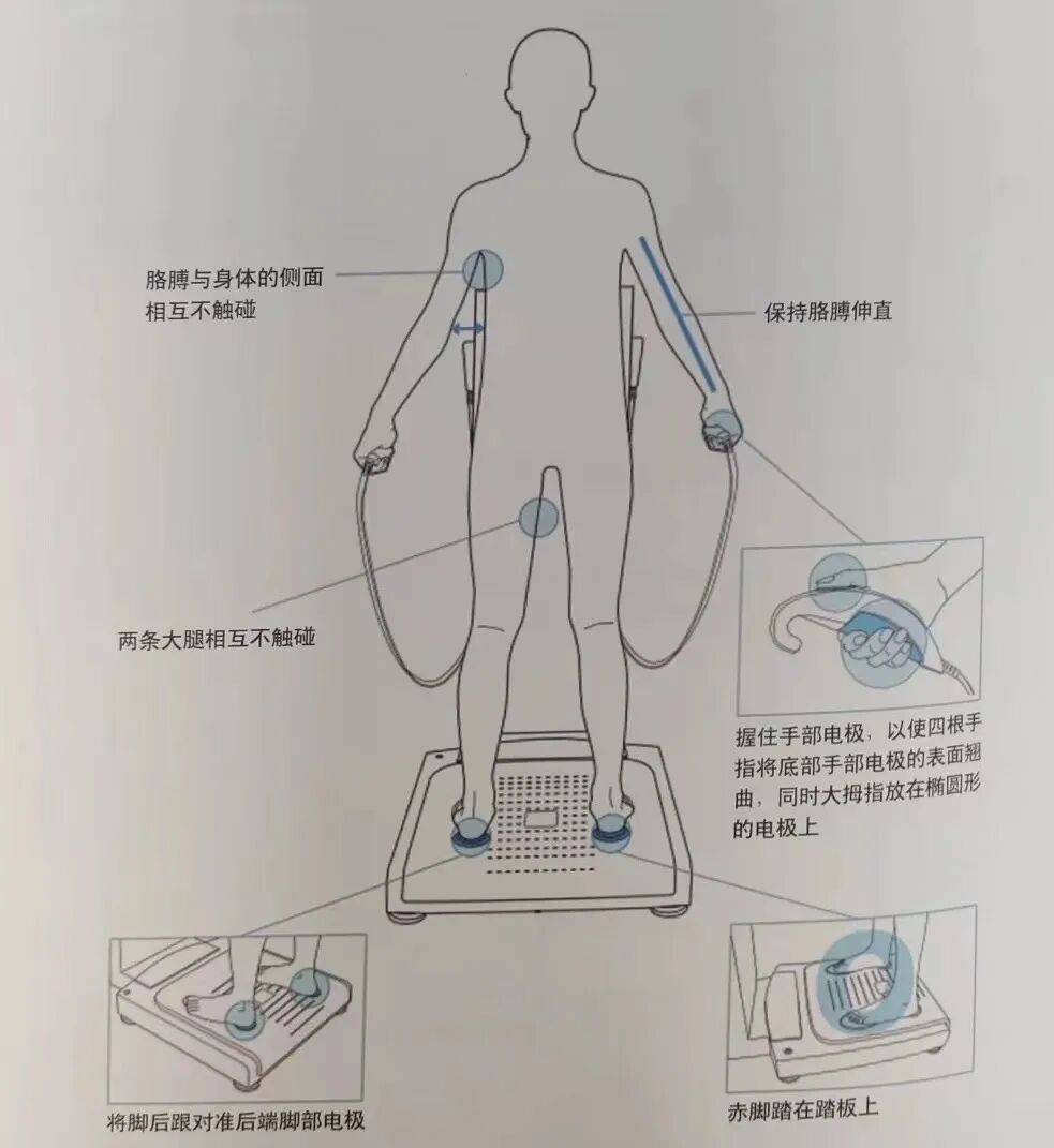 inbody身体水分为什么会少Inbody人体成分分析让我们更清楚地了解自己_https://www.jmylbn.com_新闻资讯_第12张