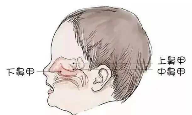 鼻甲肥大不调理小心失去嗅觉！