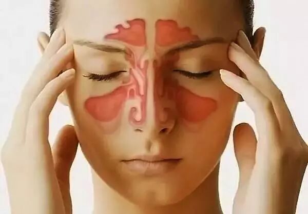 鼻窦炎有什么危害，你不注意它，它会害人性命