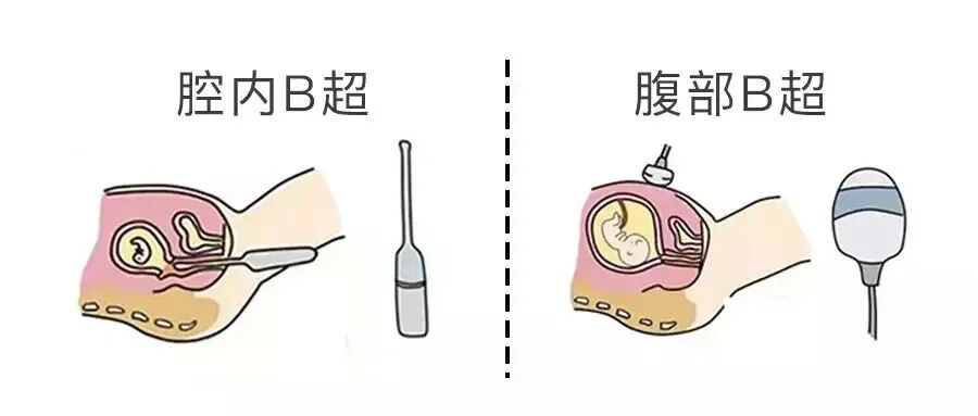 b超为什么探头发热超声检查的冷知识，你知道几条？_https://www.jmylbn.com_新闻资讯_第5张