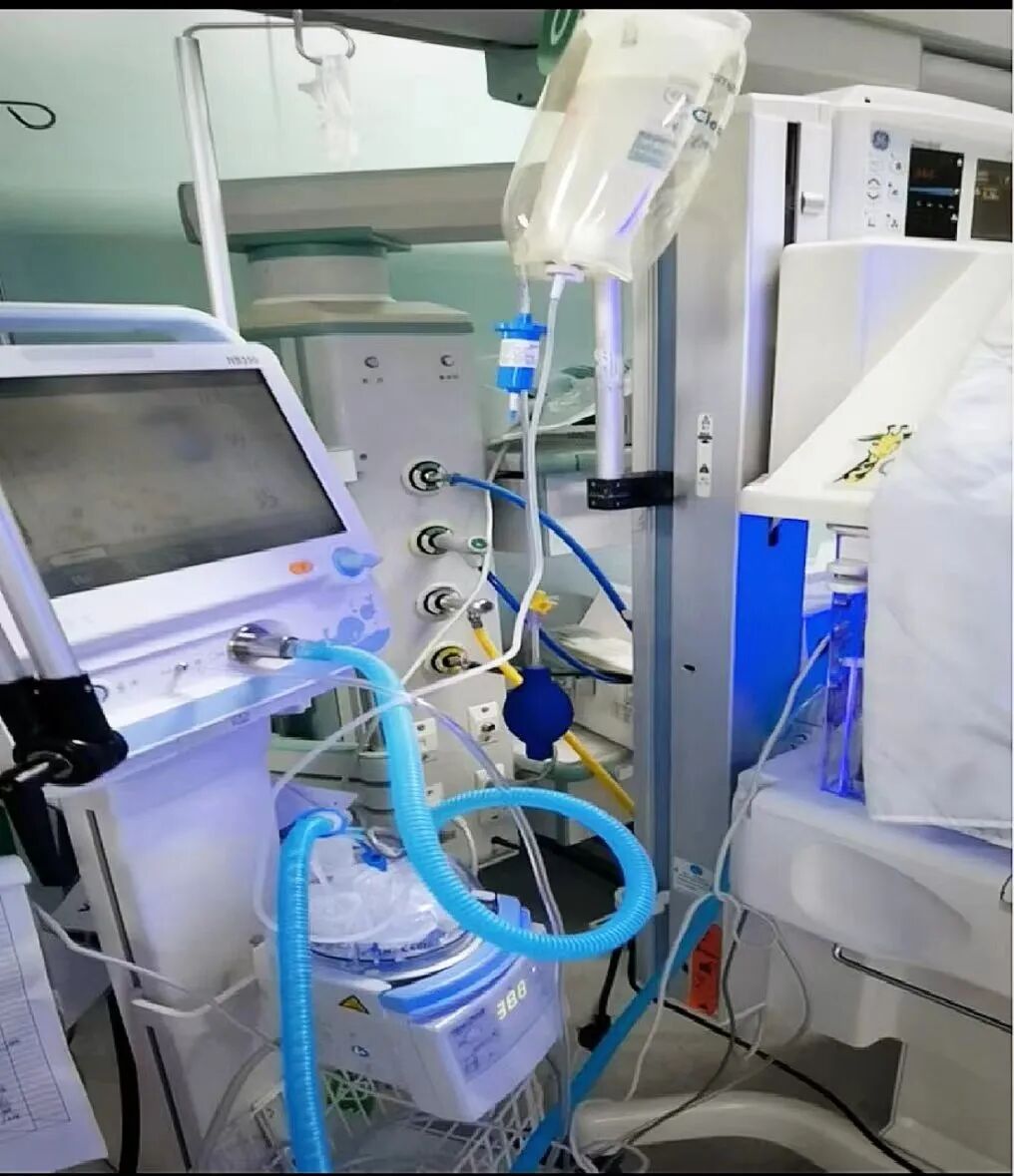 为什么呼吸机需要加湿“可视”“有感”专项治理在行动（十三）｜ 输液加压带  改善呼吸机加湿化水方式_https://www.jmylbn.com_新闻资讯_第11张