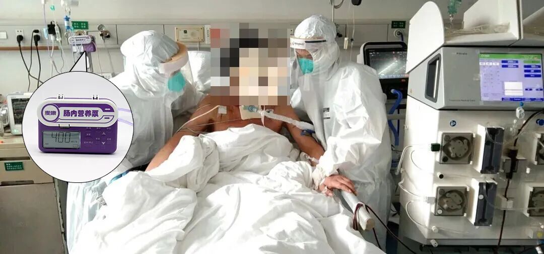 为什么用营养泵肠内营养泵持续喂养应用于危重患者的临床观察_https://www.jmylbn.com_新闻资讯_第3张