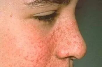 半导体激光治疗仪怎么样中医科新设备--半导体激光治疗仪_https://www.jmylbn.com_新闻资讯_第18张