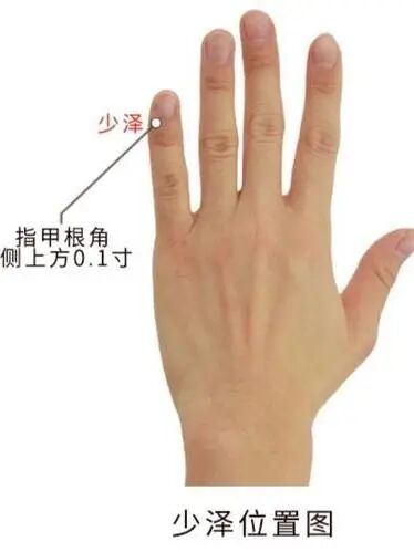 射频电疗是什么【新项目新技术】南陵县医院妇产科创新升级：产后乳房穴位按摩联合射频电疗术，助力新妈妈舒适康复_https://www.jmylbn.com_新闻资讯_第5张