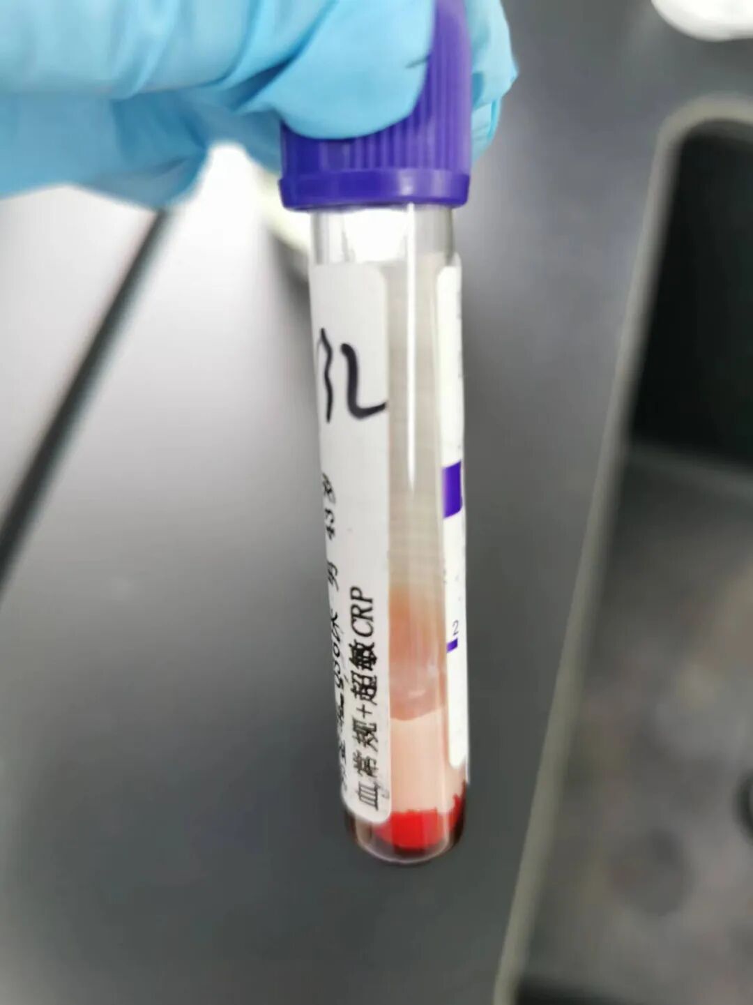 rbc直方图怎么看血常规审核：「三三原则」从哪来？怎么用？这篇说明白了_https://www.jmylbn.com_新闻资讯_第5张