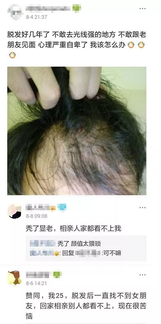 @云南人，秃顶、稀疏、发际线高怎么办？赶紧get这份脱发自救指南