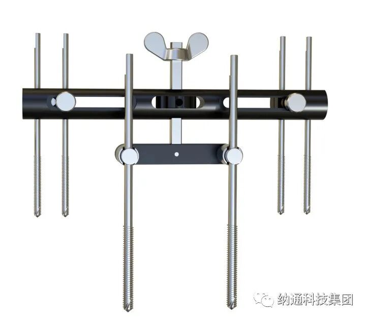 骨折固定有哪些产品正天外固定支架产品，微创治疗多种创伤骨折_https://www.jmylbn.com_新闻资讯_第14张