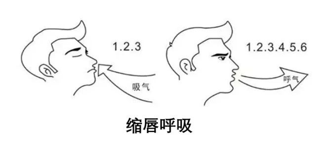 cover_image