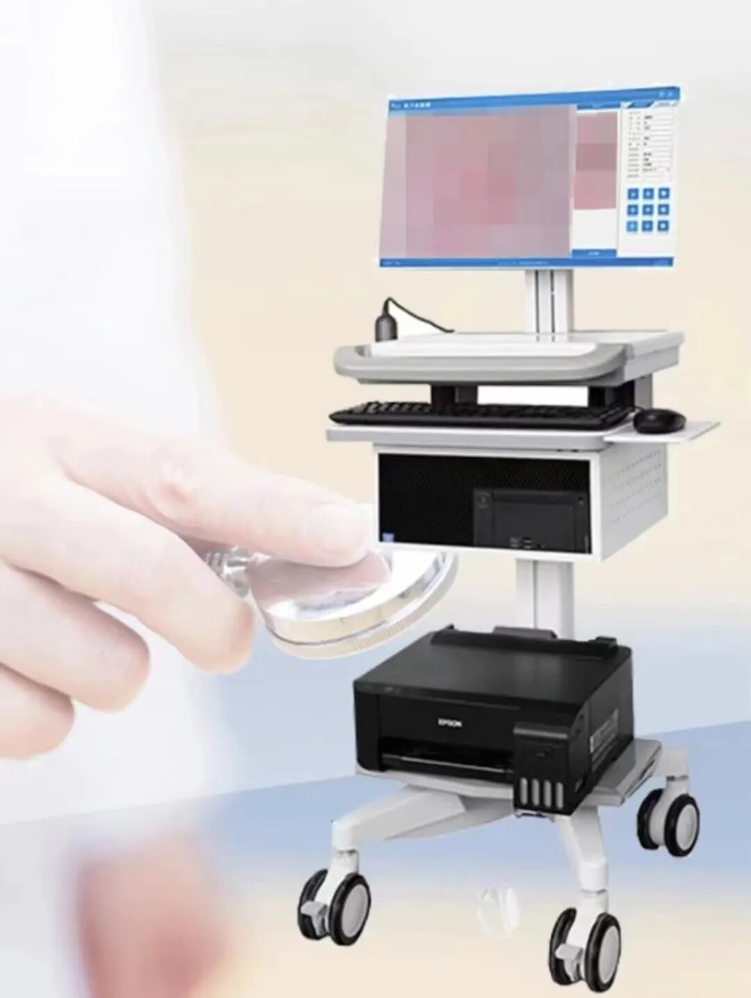 电子皮肤镜有什么用【新技术 新业务】东川区人民医院皮肤科开展电子皮肤镜检查 让皮肤病无所遁形_https://www.jmylbn.com_新闻资讯_第4张