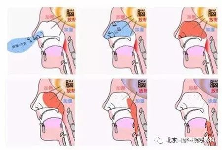 呼吸道疾病的“罪魁祸首”，你知道吗？必看的好文