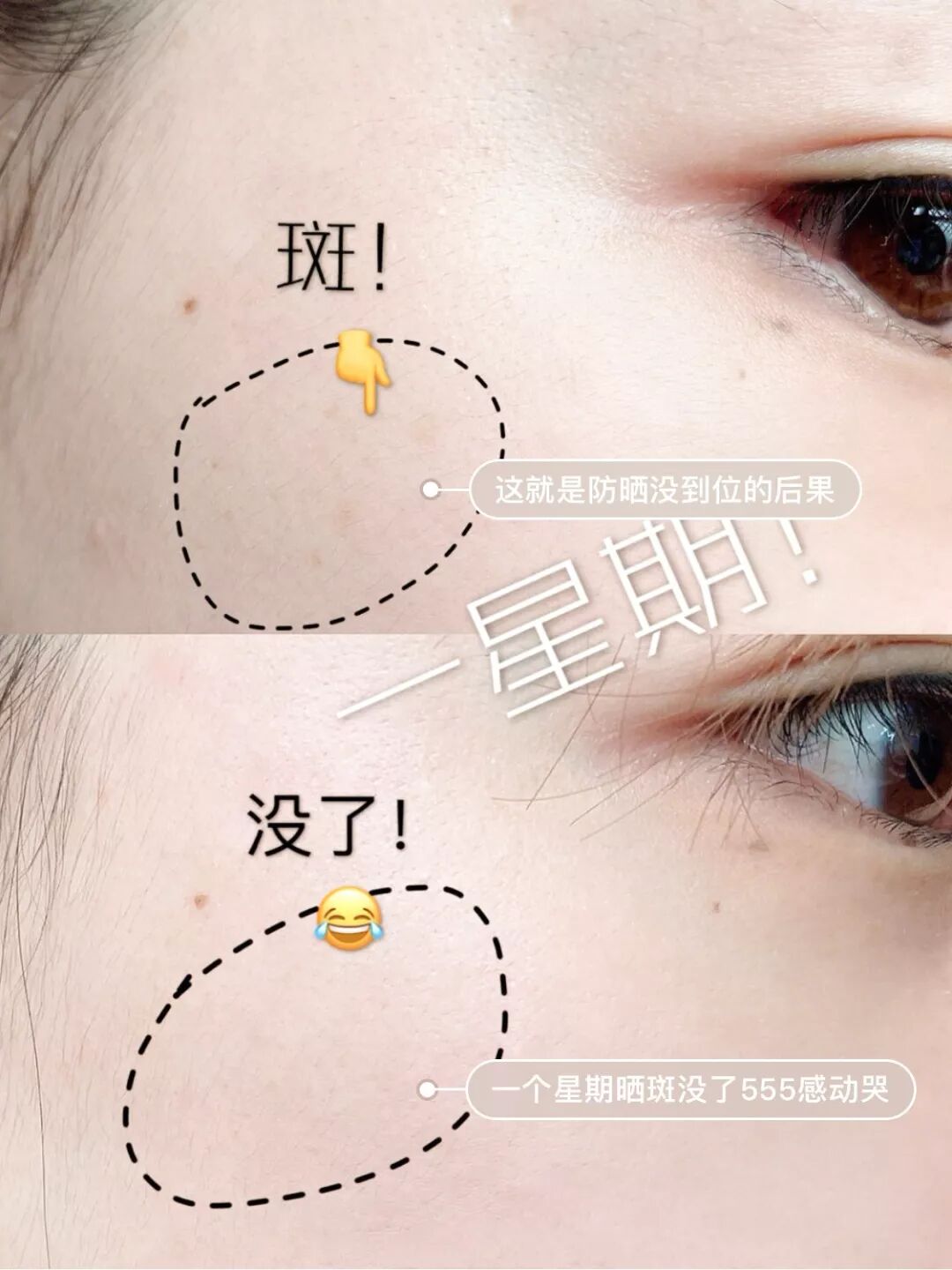 38歲全智賢美到犯規 只因白到發光 歐洲no 1美白霜 連胎記都去無蹤 爸媽營 微文庫