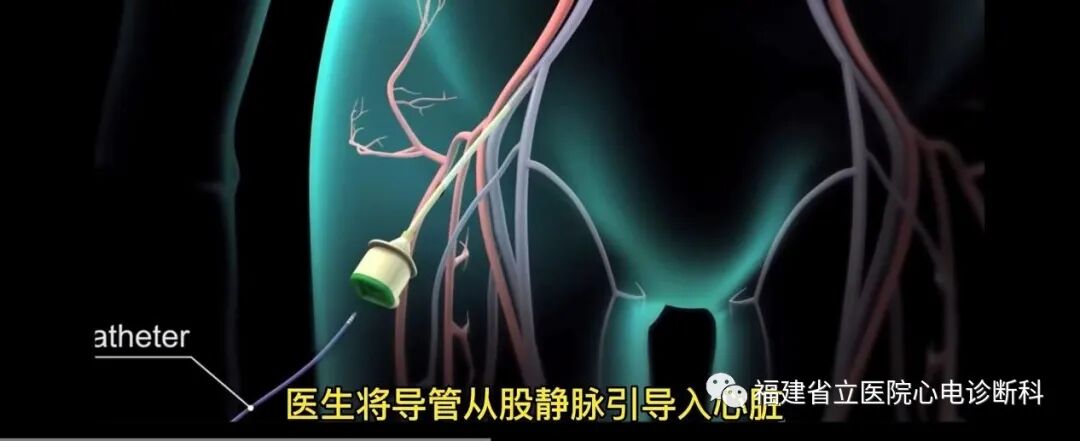 “快慢综合征”与“慢快综合征”的区别与联系
