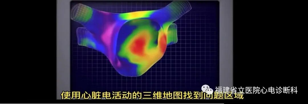 “快慢综合征”与“慢快综合征”的区别与联系