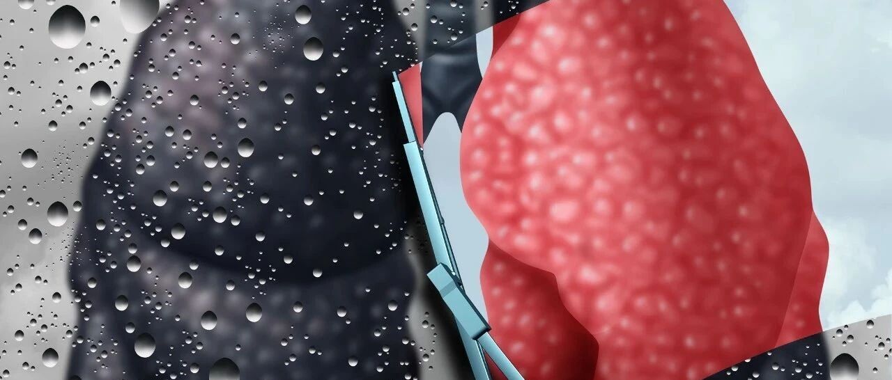 美国胸科学会新指南：对烟草依赖的吸烟者如何进行药物治疗