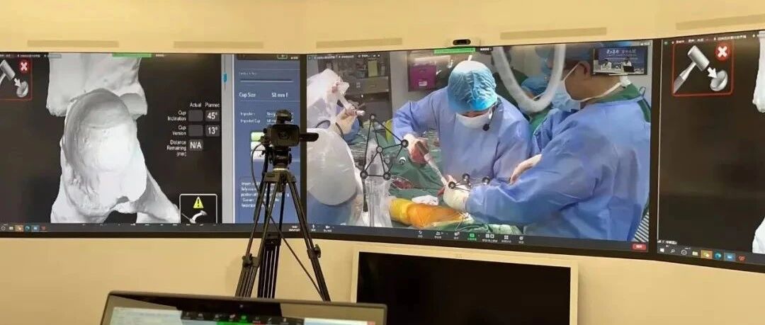 这个手术“利器”，帮助偏远地区基层医院更好治疗骨科疾病